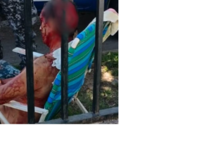 Perro ataca a un hombre y le provoca heridas de gravedad en el barrio de Villa Adela