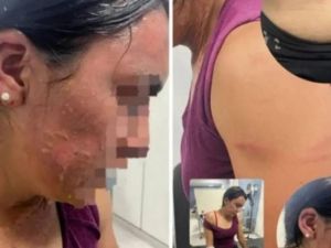 Ataque en Tucumán: le arrojaron agua hirviendo en un partido de hockey y piden detenciones