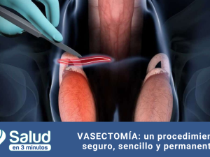 Vasectomía: mitos y verdades sobre uno de los métodos anticonceptivos más efectivos